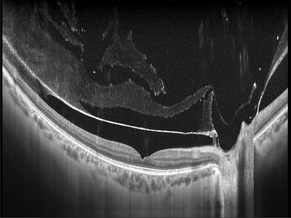 Tomograf in coerenta optica YALKAID YG-100K OPTO HELLAS 