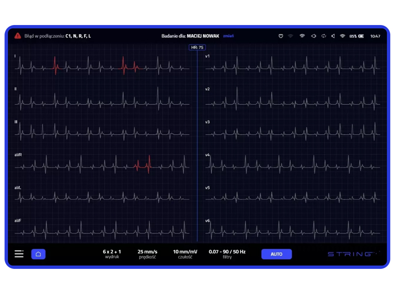 Electrocardiograf String Opus 1, cu 12 canale 