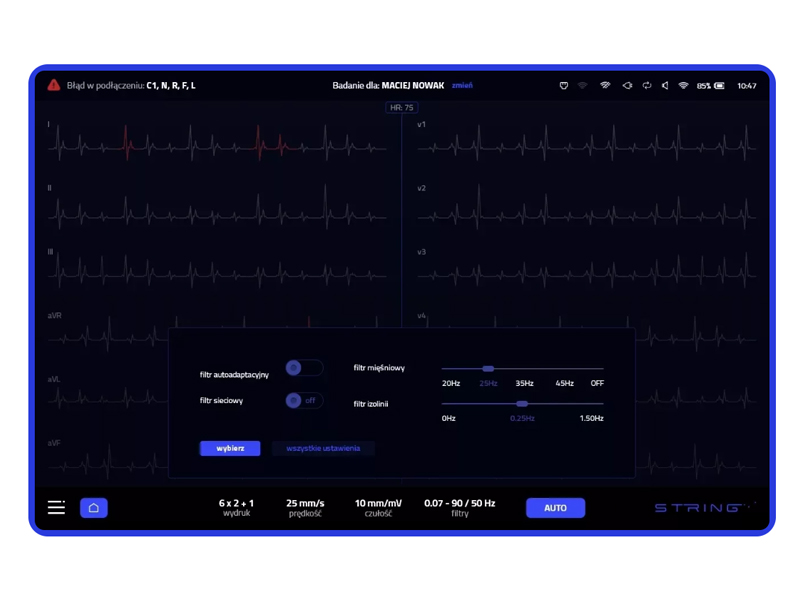 Electrocardiograf String Opus 1, cu 12 canale 