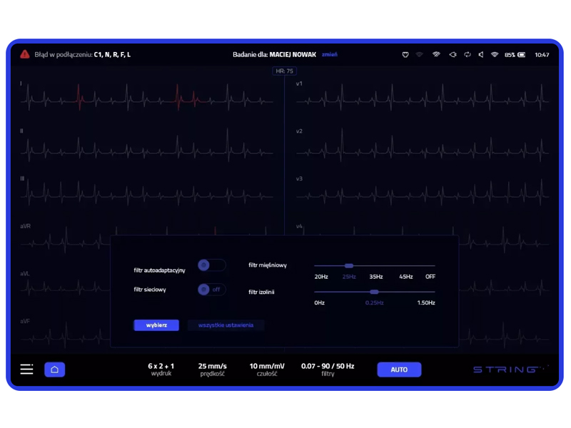 Electrocardiograf String Opus Mini, cu 12 canale 