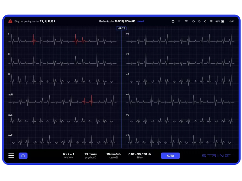 Electrocardiograf String Opus Mini, cu 12 canale 