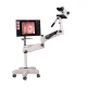 Colposcop optic AC-5000XV2 