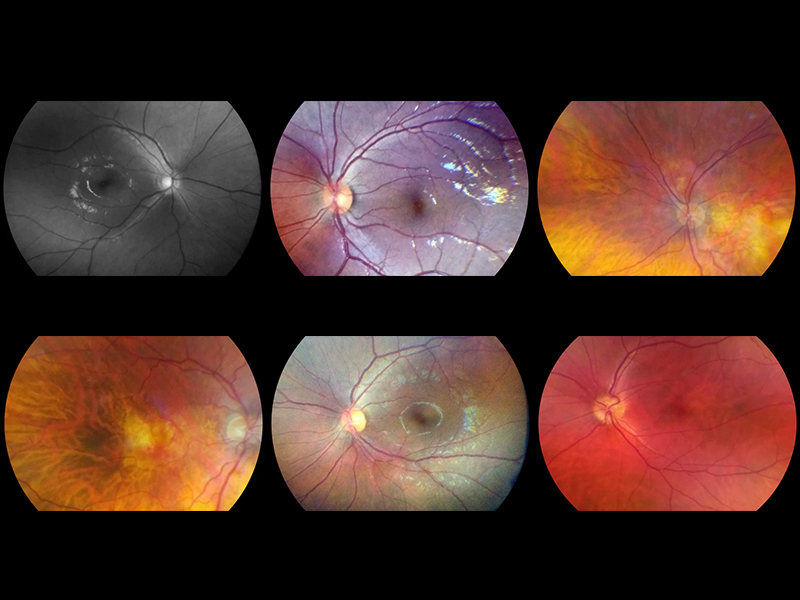 Fundus camera VISTA VIEW 