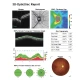 Examinare făcută cu Tomograf in coerenta optica cu Fundus camera integrata VISION 700 