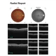 Examinare făcută cu Tomograf in coerenta optica cu Fundus camera integrata VISION 700 