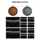 Examinare făcută cu Tomograf in coerenta optica cu Fundus camera integrata VISION 700 