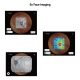 Examinare făcută cu Tomograf in coerenta optica cu Fundus camera integrata VISION 700 