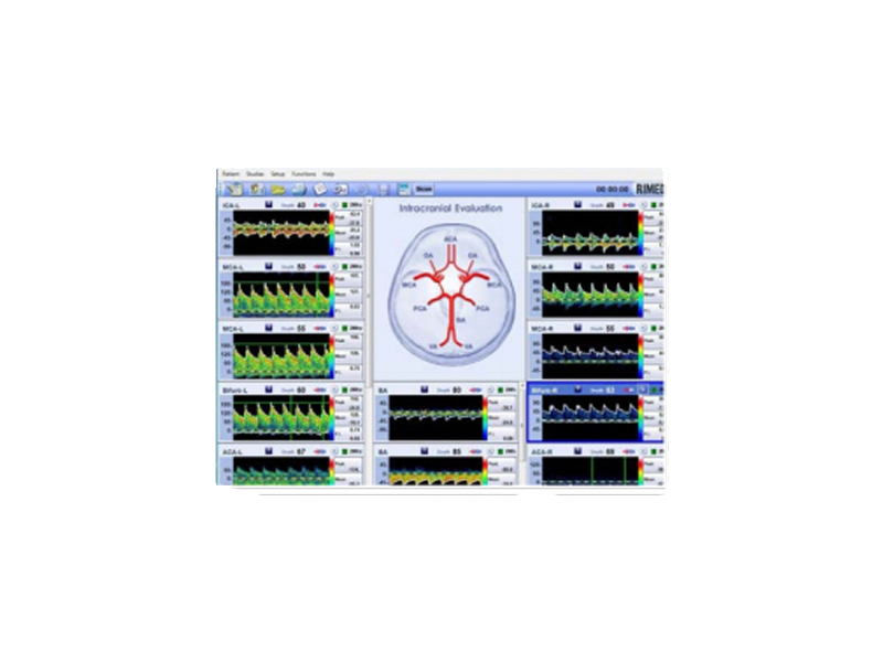 Soft evaluare indice VMR (Vaso Motor Reactivity) DIGI-LITE