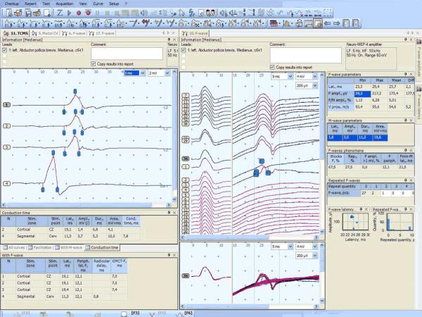 Monitor ATI C80