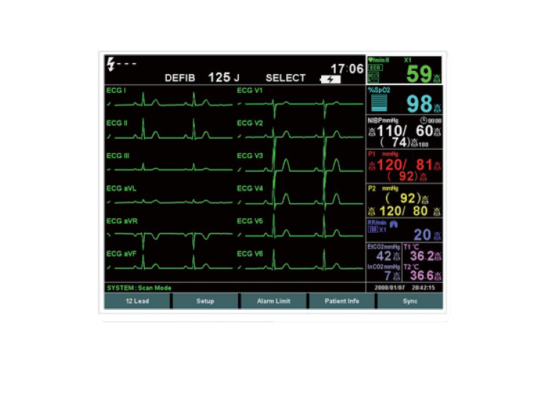 Software masuratori ECG cu 12 canale 