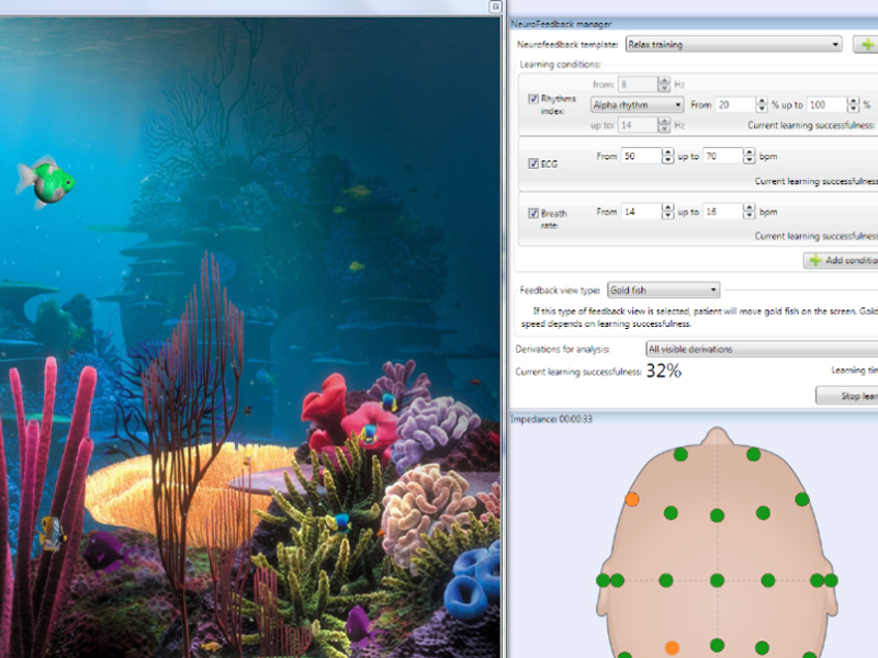 Soft si accesorii NeuroFeedBack/BioFeedBack NEURON-SPECTRUM-BFB