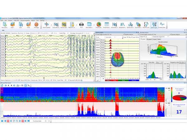 Electroencefalograf - 25 canale NEURON-SPECTRUM-64