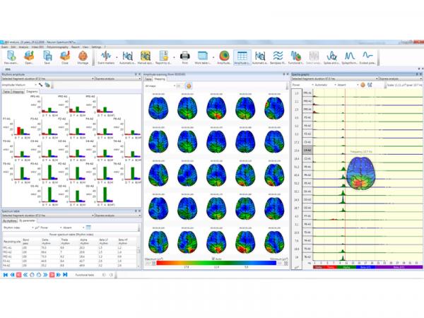 Electroencefalograf - 25 canale NEURON-SPECTRUM-64