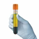 Eprubete PRP, set 2buc 