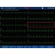 Examinare făcută cu Electrocardiograf iMAC 120 